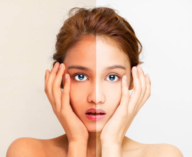 Skin Whitening Treatments That Actually Work