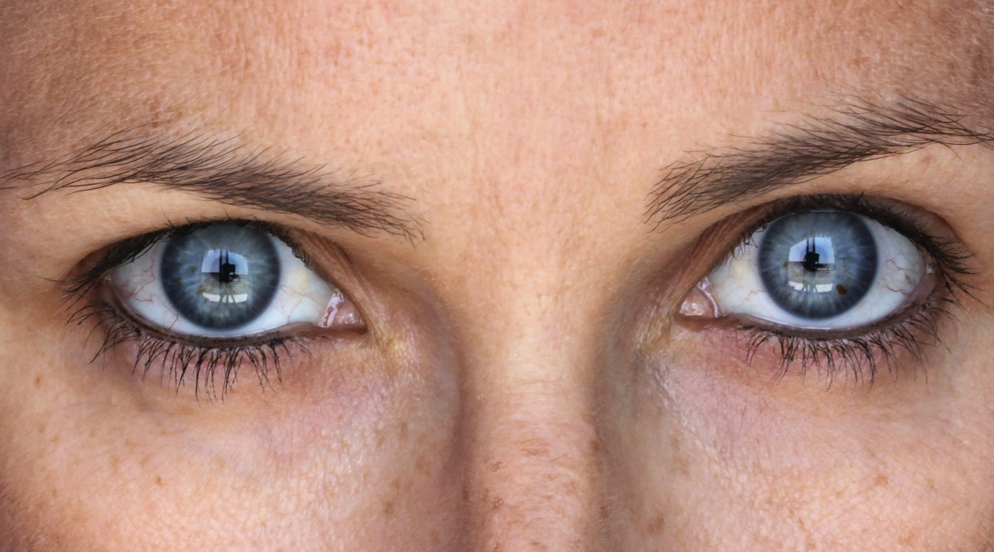 A woman's face with skin aging from the sun